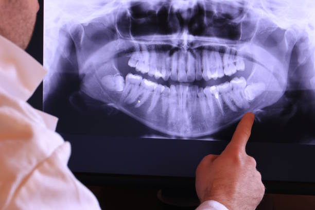 Best Emergency Treatment for Oral Infections in Arnold, MD