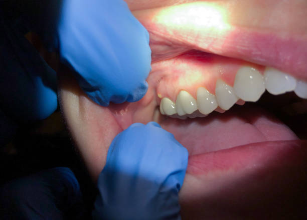 Best Emergency Cosmetic Dentistry (e.g., broken veneers) in Arnold, MD